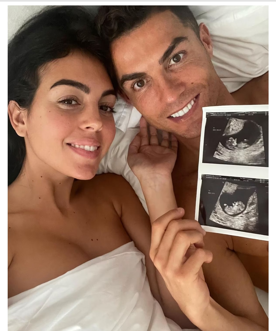 C’Ronaldo, Partner Expecting Twins – France 24