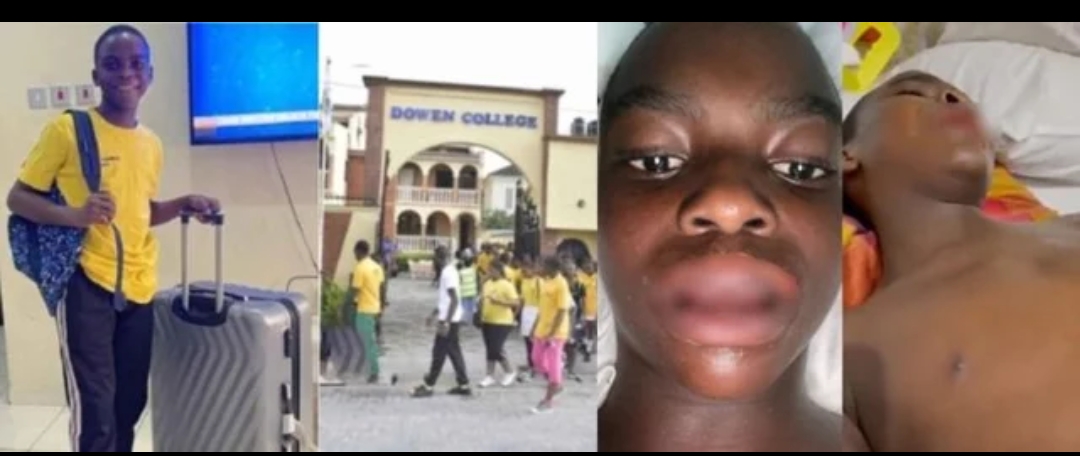 Family Releases Video Showing Dowen Pupil Bleeding From Mouth After Alleged Torture By Colleagues