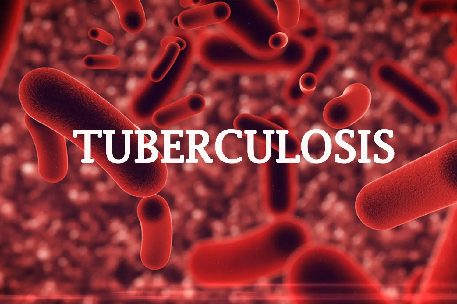 TB: Major Partners Collaborate To Boost Rapid Molecular Tests